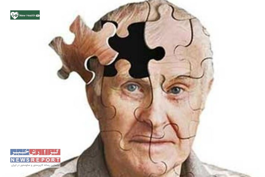 همه‌چیز درباره آلزایمر؛ شایع‌ترین نوع زوال عقل در سالمندان