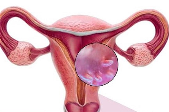 HPV شایع‌ترین عفونت مقاربتی جهان؛ هشدار متخصصان درباره پیامدهای خاموش این ویروس