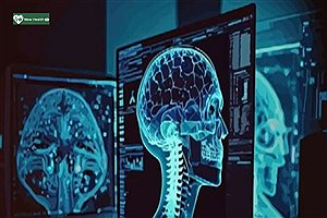 آینده درمان سرطان زیر و رو می‌شود؛ هوش مصنوعی فرمان را به‌دست می‌گیرد