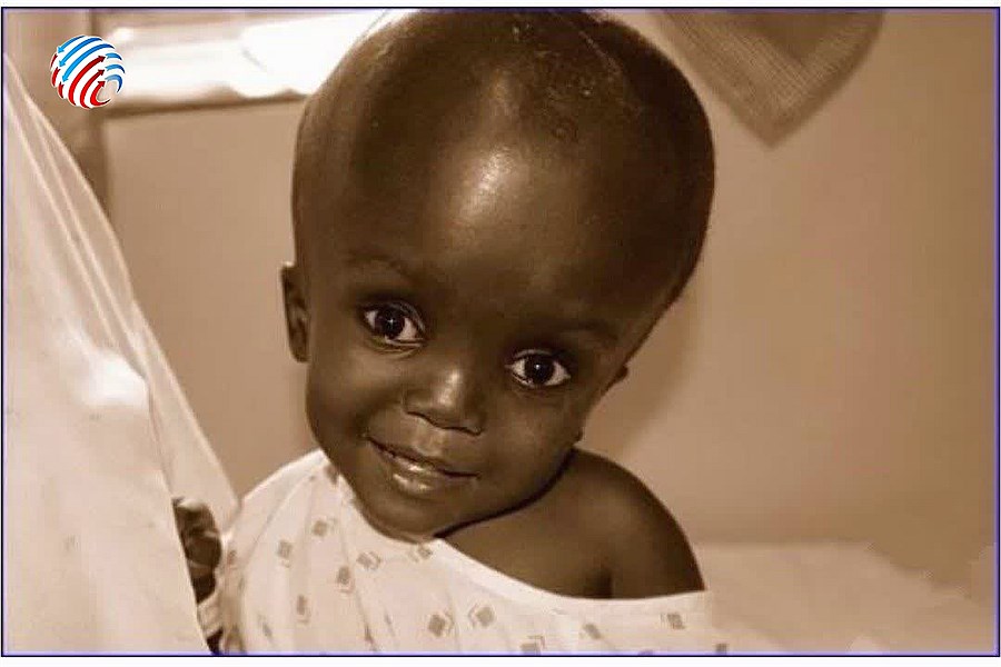 نخستین عمل جراحی شانت قابل برنامه‌ ریزی با موفقیت در بیمارستان حاج محمود حاج حیدر لامرد انجام شد